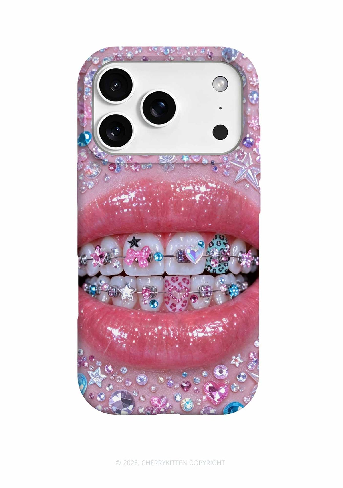 Sparkle Braced Mouth Art Y2K Phone Case Cherrykitten