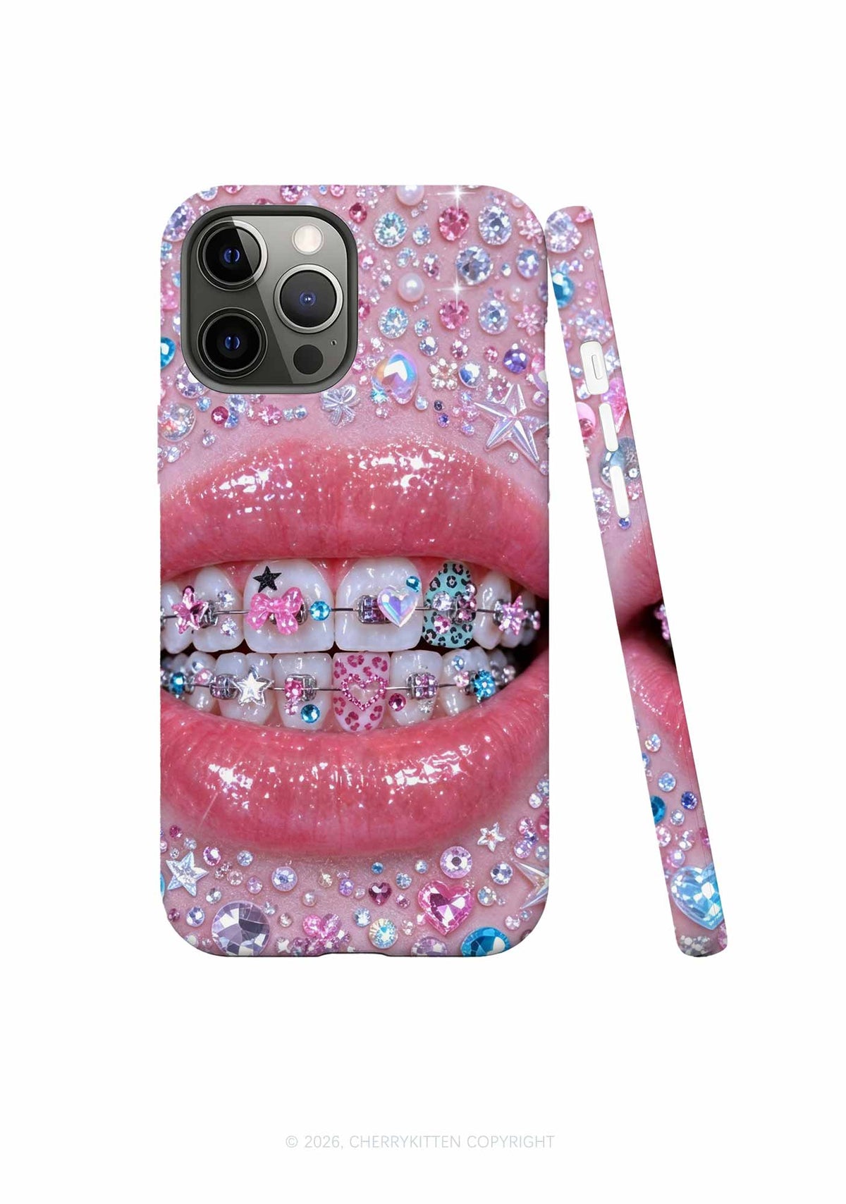 Sparkle Braced Mouth Art Y2K Phone Case Cherrykitten
