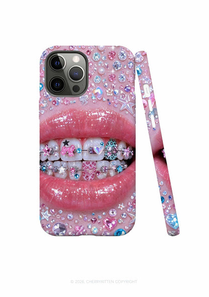 Sparkle Braced Mouth Art Y2K Phone Case Cherrykitten