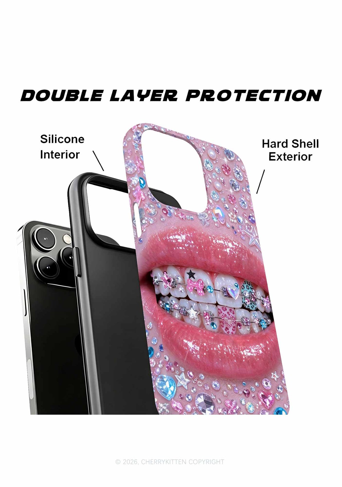 Sparkle Braced Mouth Art Y2K Phone Case Cherrykitten